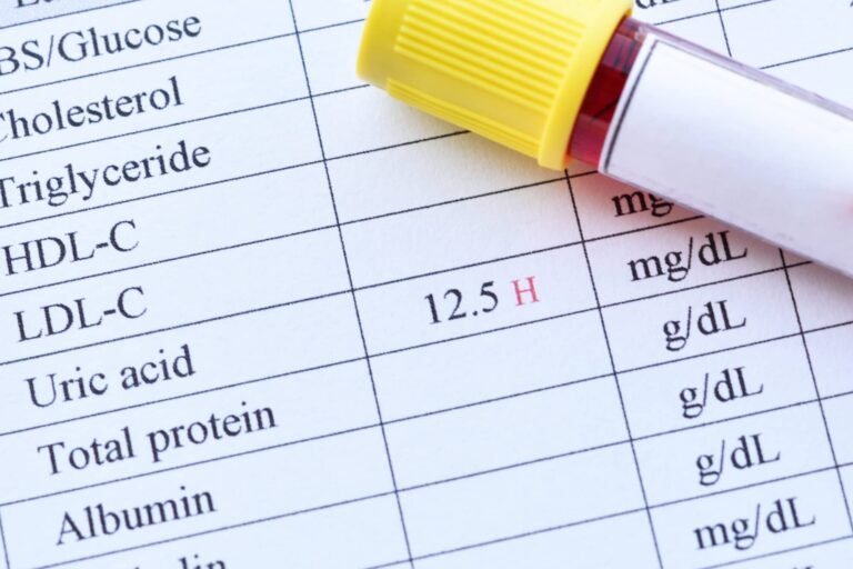 Uric Acid